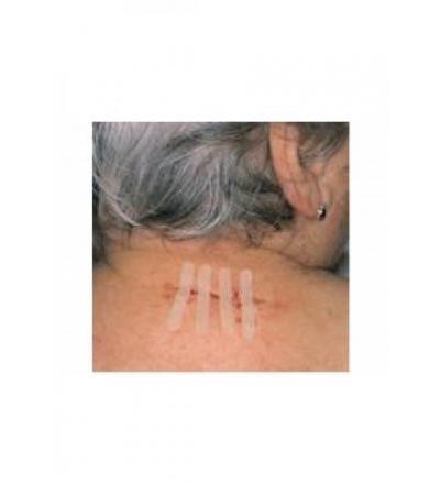 OMNISTRIP Wundnahtstreifen 12x101mm 300 Stk